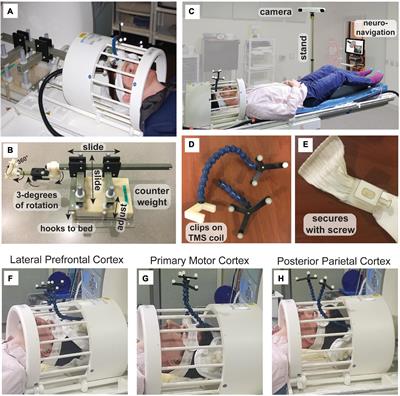 A guide for concurrent TMS-fMRI to investigate functional brain networks